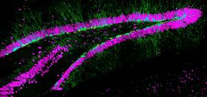 Neurogenesi-adulta_gasparini-big